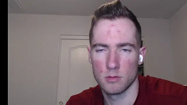 Snapshot of rawdawgrex chatting on March 7, 2026, 7:16 am rawdawgrex online show from March 7, 2026, 7:16 am